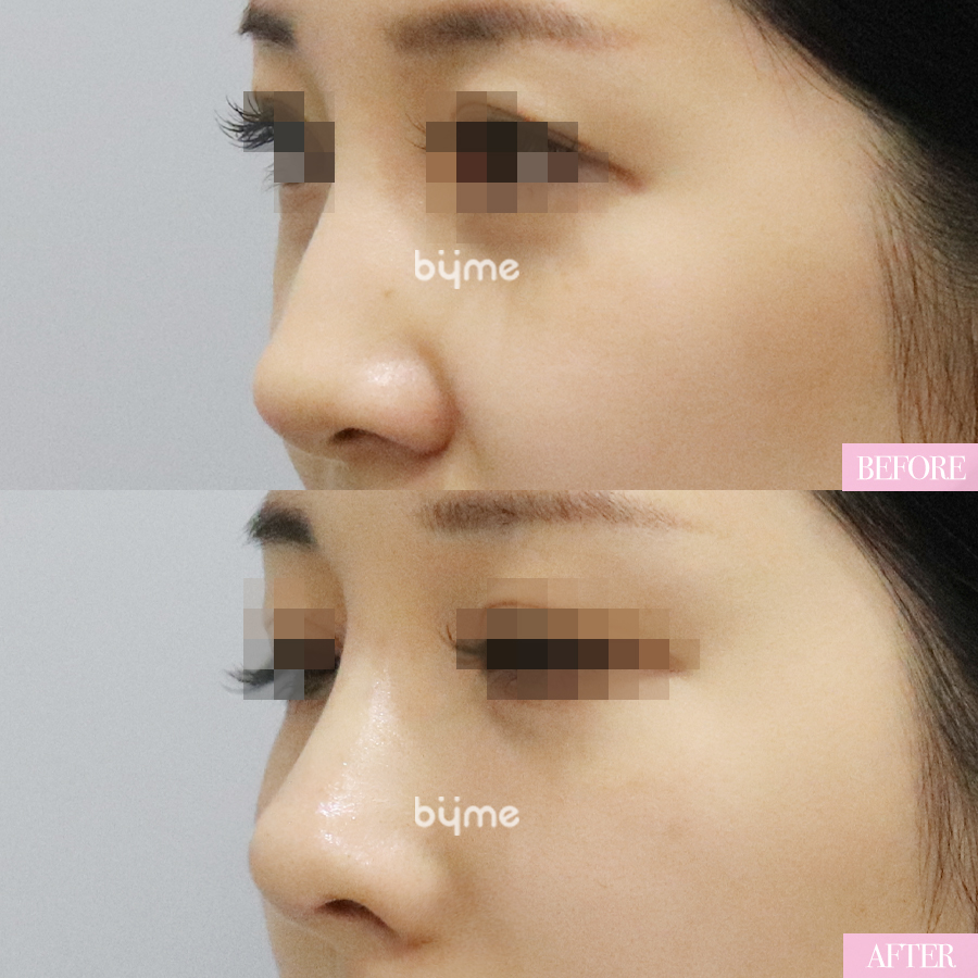 코프팅_김예진_사선.jpg